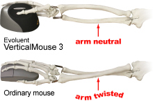 Forearm Twisting